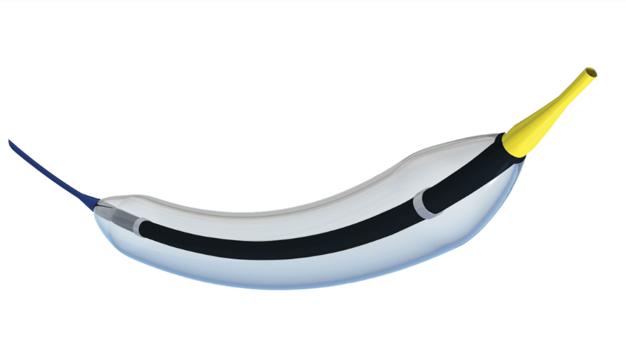 <a href=https://insitu-tech.com/arriva-ptca-balloon-catheter/">Arriva™ & Arriva™ NC PTCA Balloon Catheters</a>